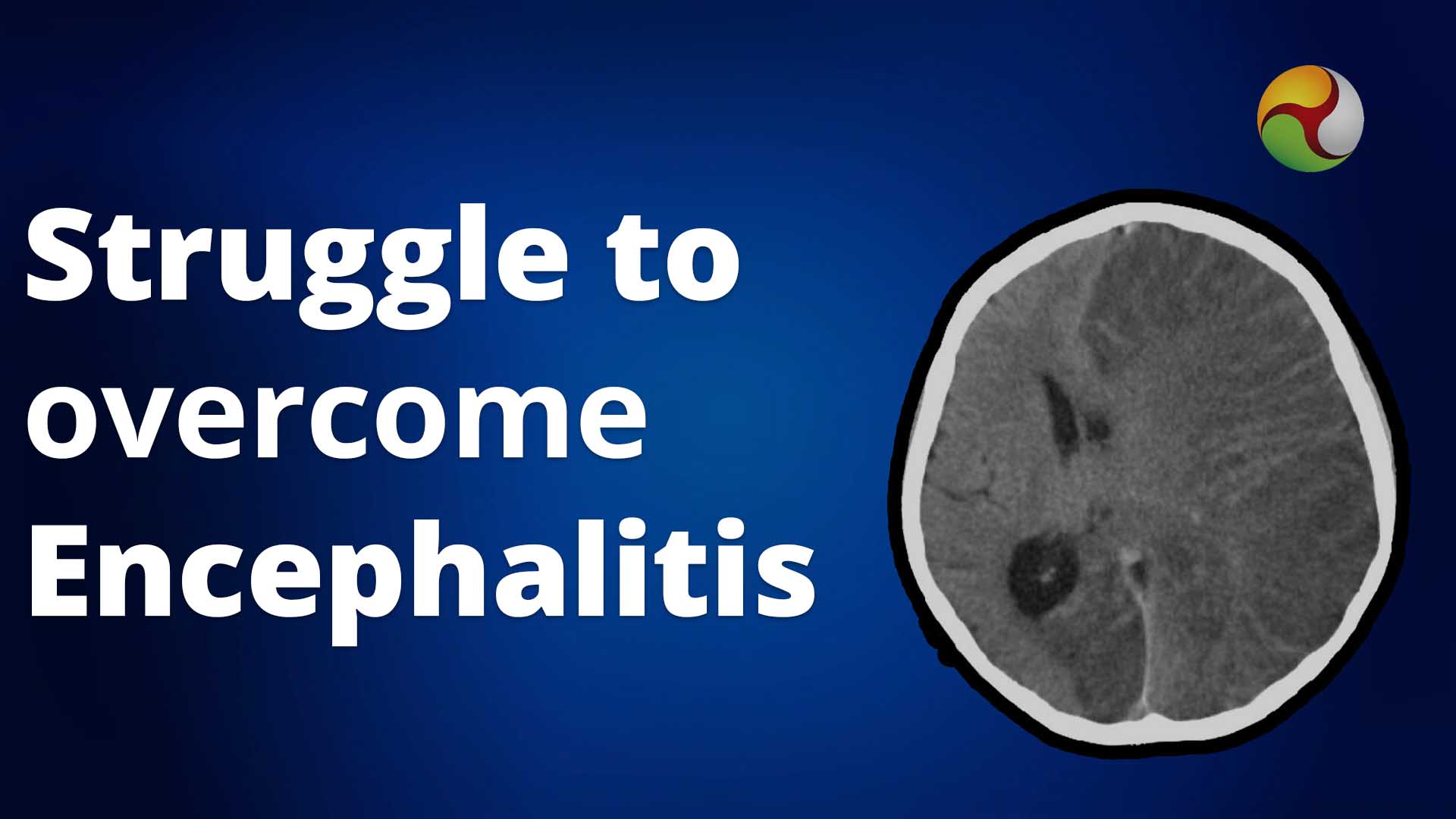 Bihar hospitals struggle to overcome Encephalitis outbreak