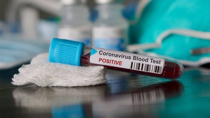 COVID-19, coronavirus, India, Coronavirus tests, DGCI