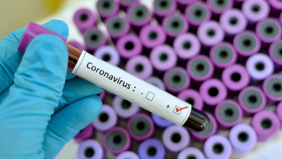 India among top 30 countries at ‘high risk’ from coronavirus spread: Study