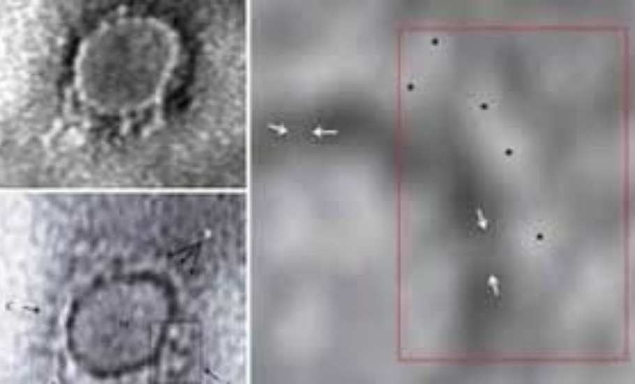 Pune scientists capture first images of COVID-19 virus
