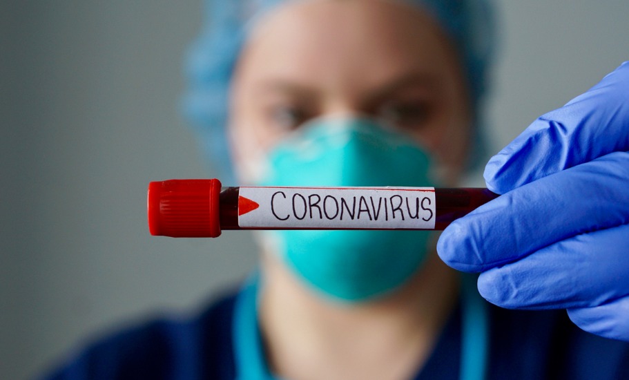 Coronavirus was spreading in NYC in February, came via Europe