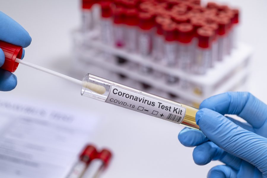 No more ₹4,500 cap on COVID-19 tests at private labs: ICMR