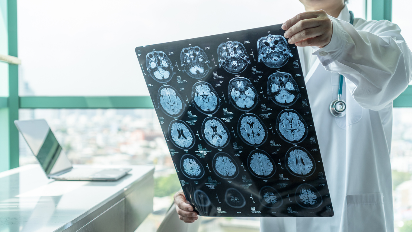 Researchers develop ‘Hyperelastic Model’ to understand brain injuries