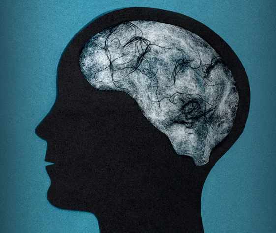 COVID-19, brain inflammation, Parkinson's disease