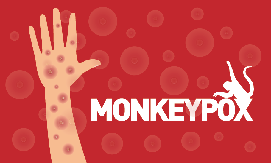 Monkeypox outbreak: Worried WHO calls emergency meeting