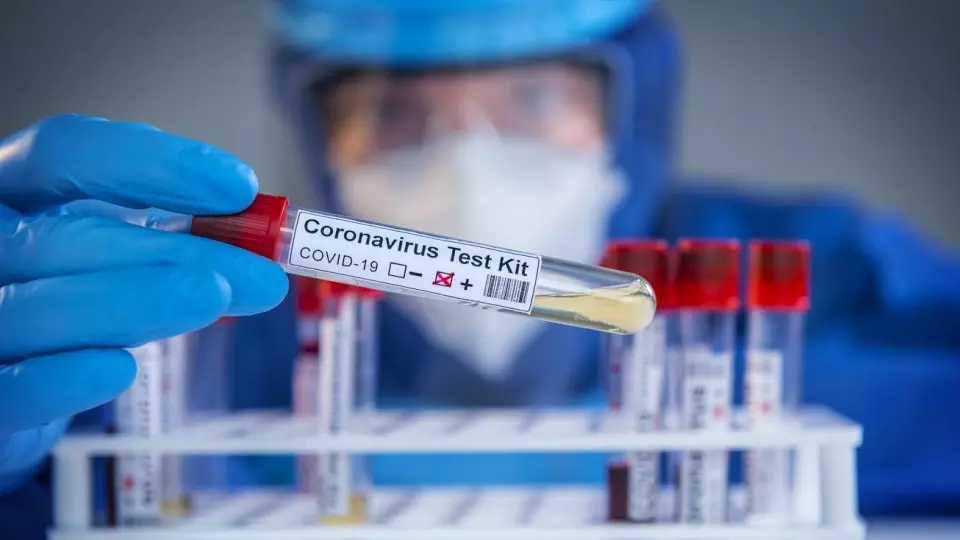 COVID-19, daily cases, Union health ministry data