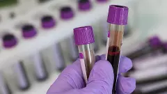 Nipah outbreak in Kerala: Two deaths; two more tested positive