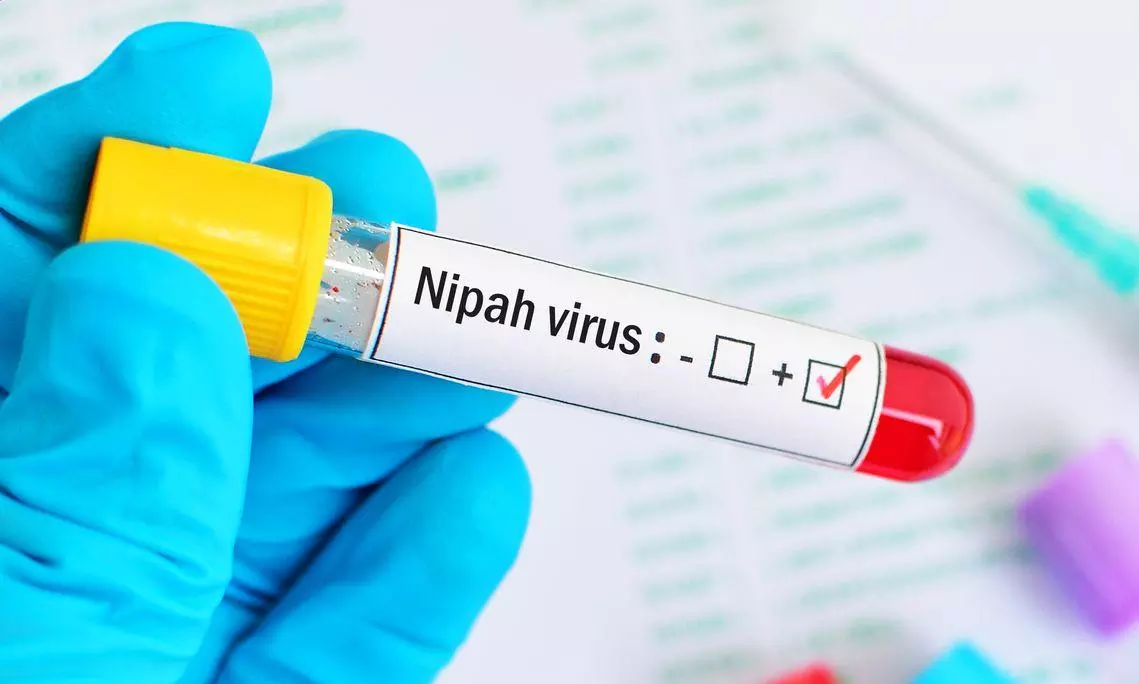 Nipah infection confirmed in 14-yr-old boy in Kerala: Health minister