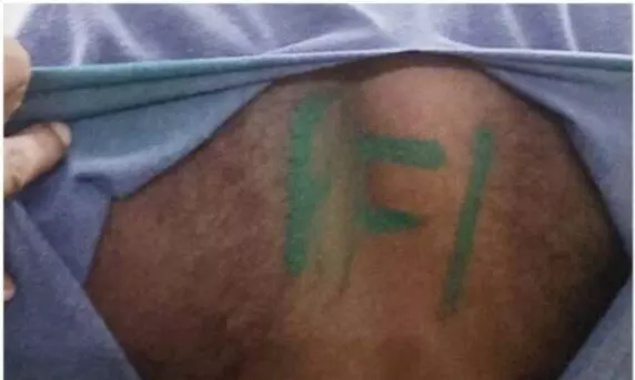 Kerala: Soldier attacked in Kollam, PFI painted on his back in green