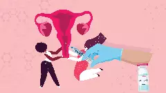 Cervical cancer, NHFC, World Health Organisation