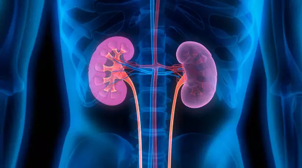Sepsis, tropical fever most common causes for acute kidney injury: Study