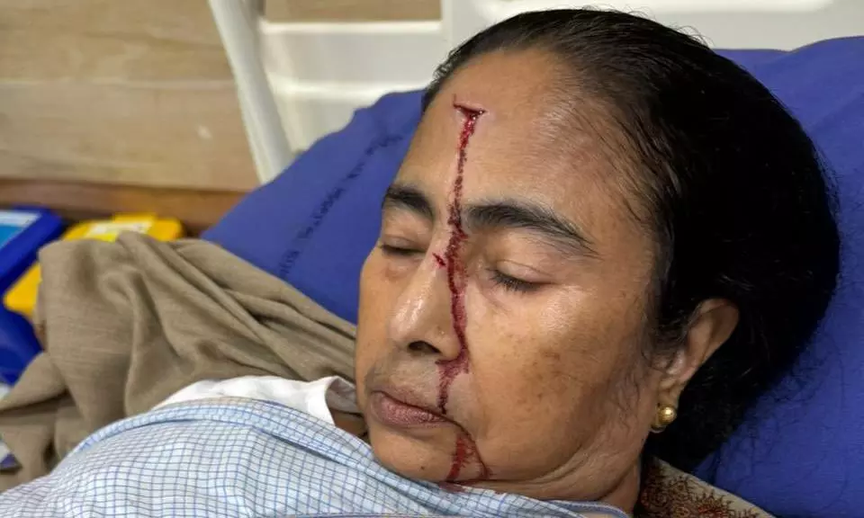 Mamata Banerjee suffers injury, discharged from hospital after treatment