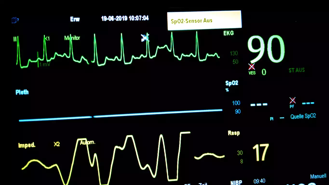ECG ECG
