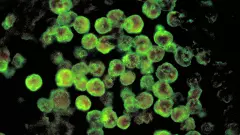 Amoebic meningoencephalitis infections: Kerala CM holds meeting on prevention