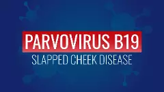 Parvovirus B19 or Slapped Cheek disease