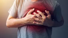 Heart attack, Cardiac arrest