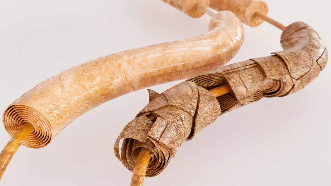 Guillain-Barré syndrome