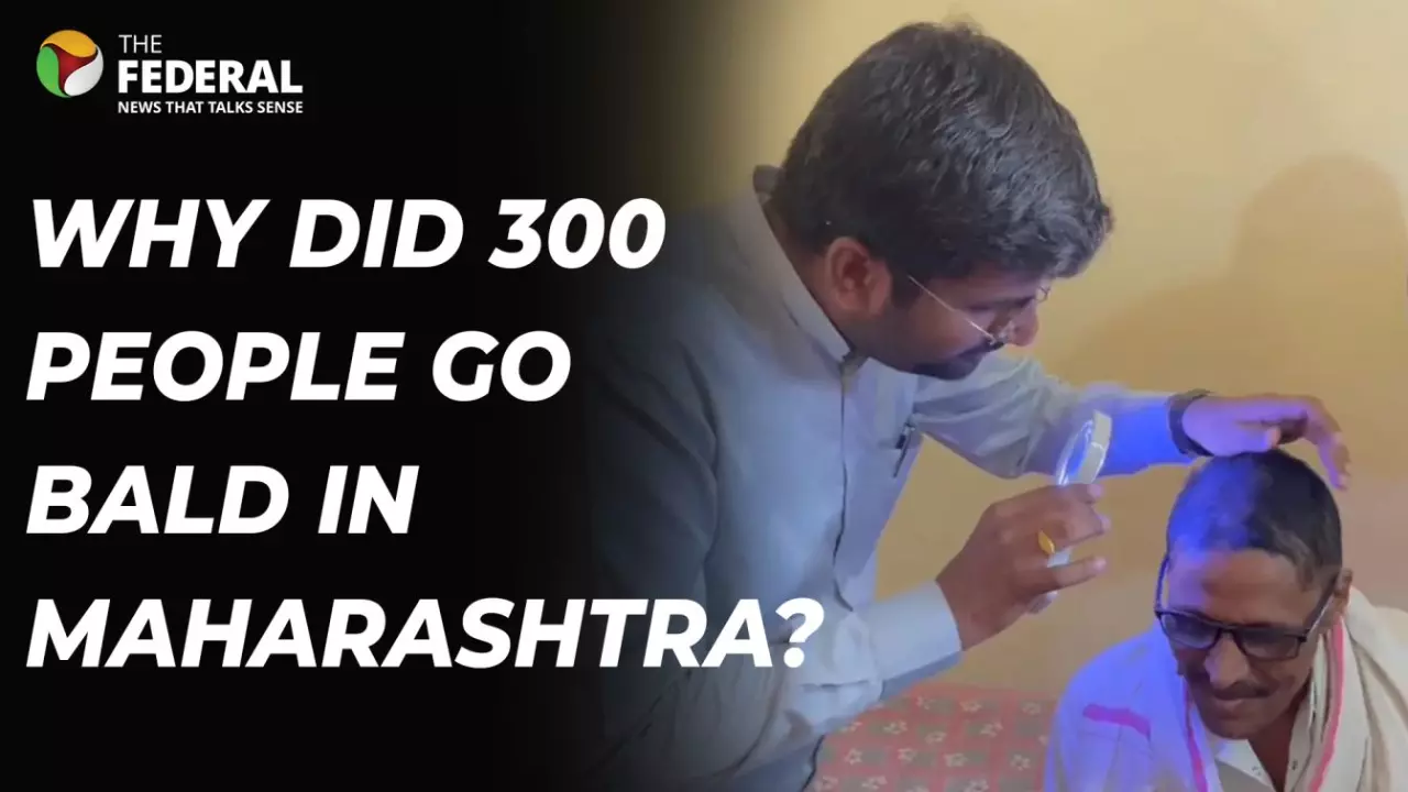 Maharashtra shocker: Did people lose hair after eating wheat? Maharashtra shocker: Did people lose hair after eating wheat?
