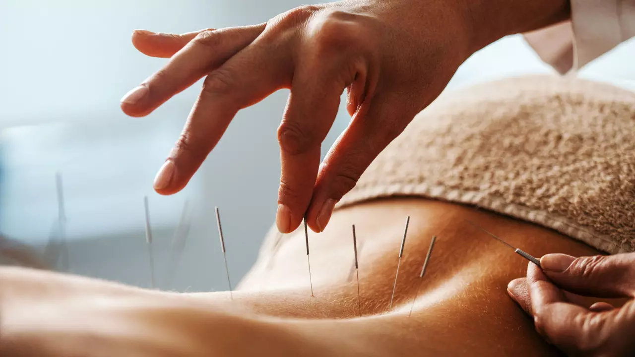 Why acupuncture in Kerala has become a health risk