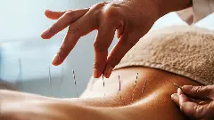 Why acupuncture in Kerala has become a health risk