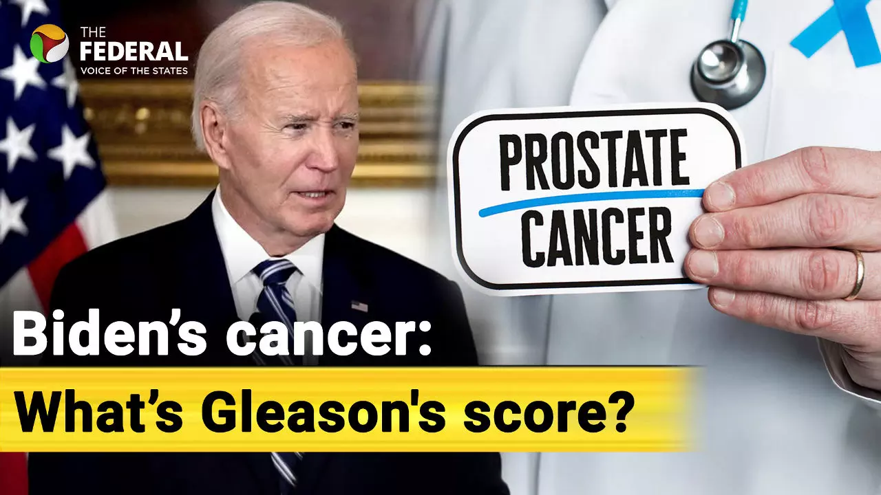 What is Prostate Cancer?