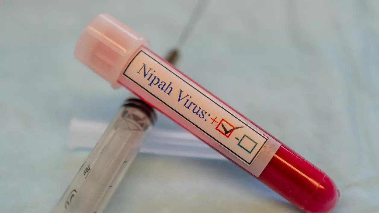 Nipah virus