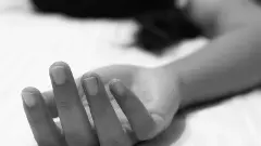 Picture of a numb hand of a woman