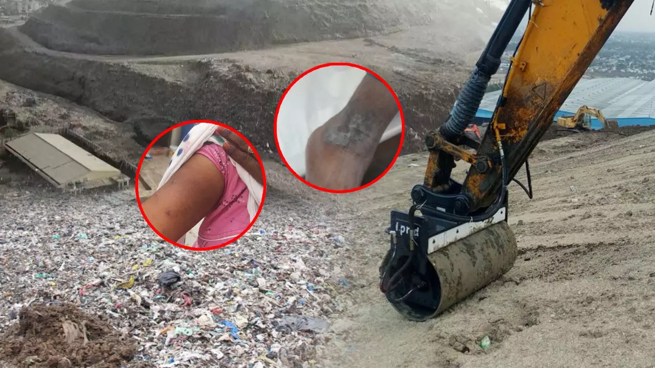 Hyderabad’s garbage capital: Jawahar Nagar’s 27-year struggle for clean air