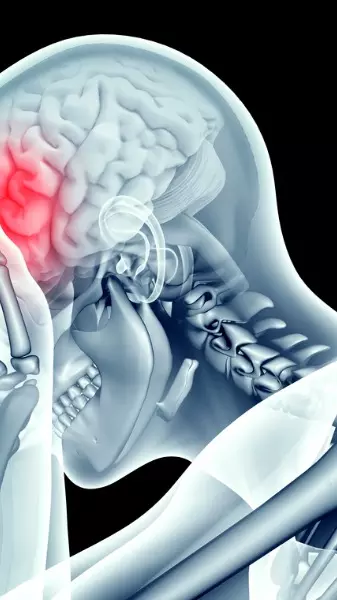 brain, blood vessels, microbleeds, head injury, trauma, MRI scans