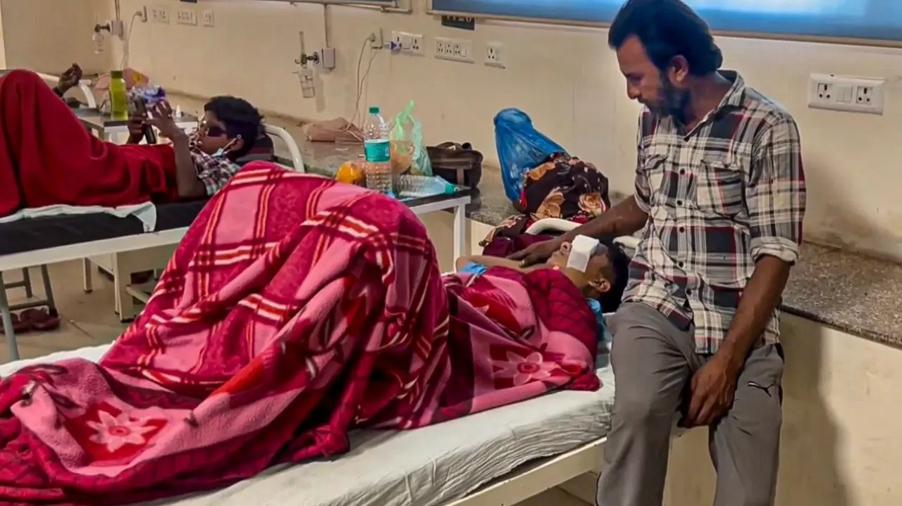 Bhopal calcium carbide injury