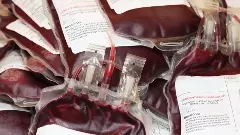 Jharkhand: Officials suspended after 5 thalassemia-affected children test HIV-positive