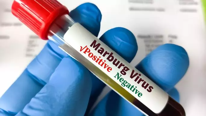Marburg virus