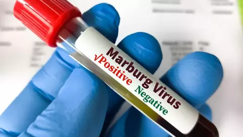 Marburg virus Marburg virus