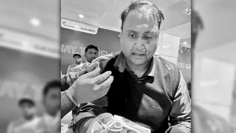 Ankit Dewan shared photographs on X showing blood on his face. Ankit Dewan shared photographs on X showing blood on his face.