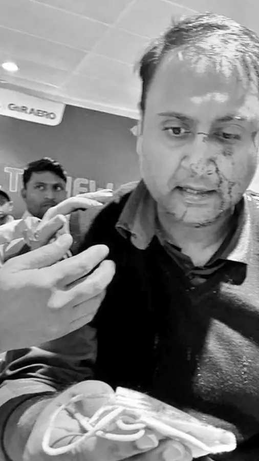 Ankit Dewan shared photographs on X showing blood on his face. Ankit Dewan shared photographs on X showing blood on his face.