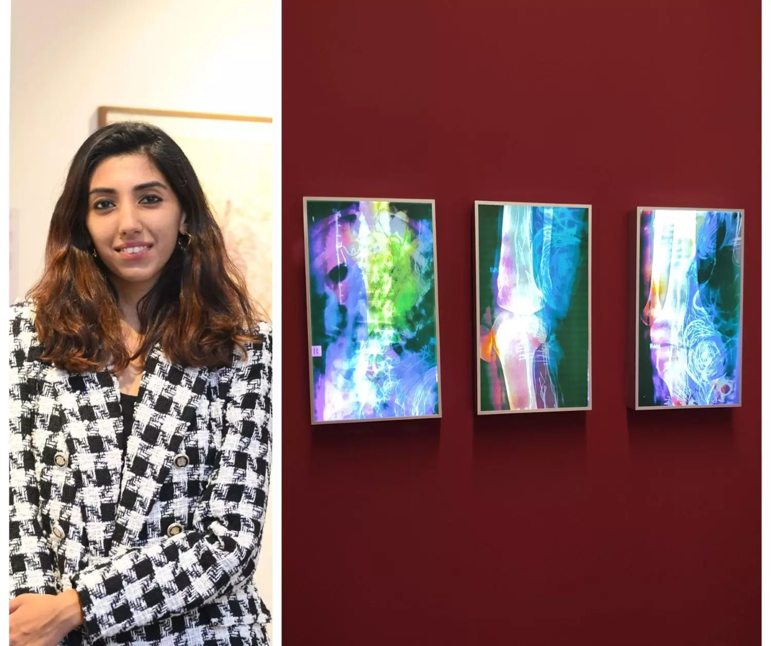 Devika Sundar has pulled out eight years of her medical scans to use it for her work, Lightboxes. The scans are stretched over illuminated shoe-sized boxes, giving the clinical images beauty and interpretation. Photo: By special arrangement  