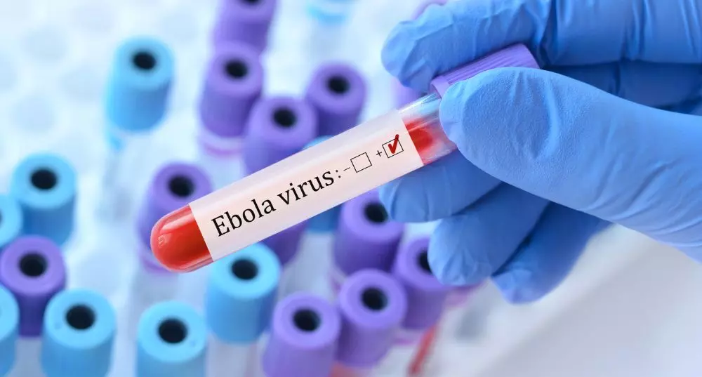 A person has to come in contact with an infected persons bodily fluids to contract the disease. This also includes sweat, which means that a crowded and hot country may theoretically see a faster spread of the disease. Photo: iStock A person has to come in contact with an infected persons bodily fluids to contract the disease. This also includes sweat, which means that a crowded and hot country may theoretically see a faster spread of the disease. Photo: iStock