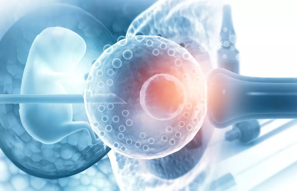Women who have undergone IVF talk of the pain of daily injections and the invasive procedure and the mental trauma of not knowing if it will be successful. Photo: iStock Women who have undergone IVF talk of the pain of daily injections and the invasive procedure and the mental trauma of not knowing if it will be successful. Photo: iStock