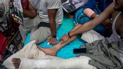 Students injured during the CJP protests