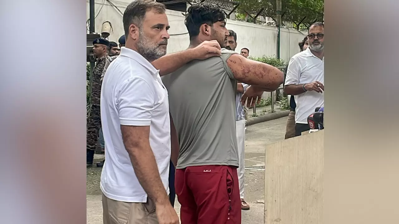 Leader of Opposition Rahul Gandhi and injured CJP protester