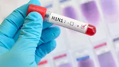 swine flu, H1N1 virus, deaths, Karnataka, SAP, IT company, shut down, outbreak, coronavirus