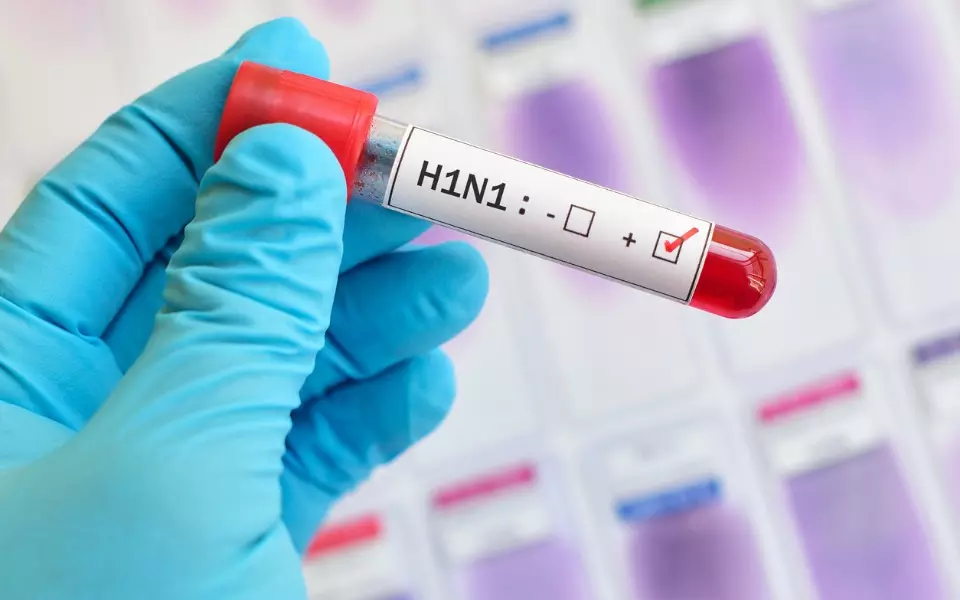swine flu, H1N1 virus, deaths, Karnataka, SAP, IT company, shut down, outbreak, coronavirus swine flu, H1N1 virus, deaths, Karnataka, SAP, IT company, shut down, outbreak, coronavirus