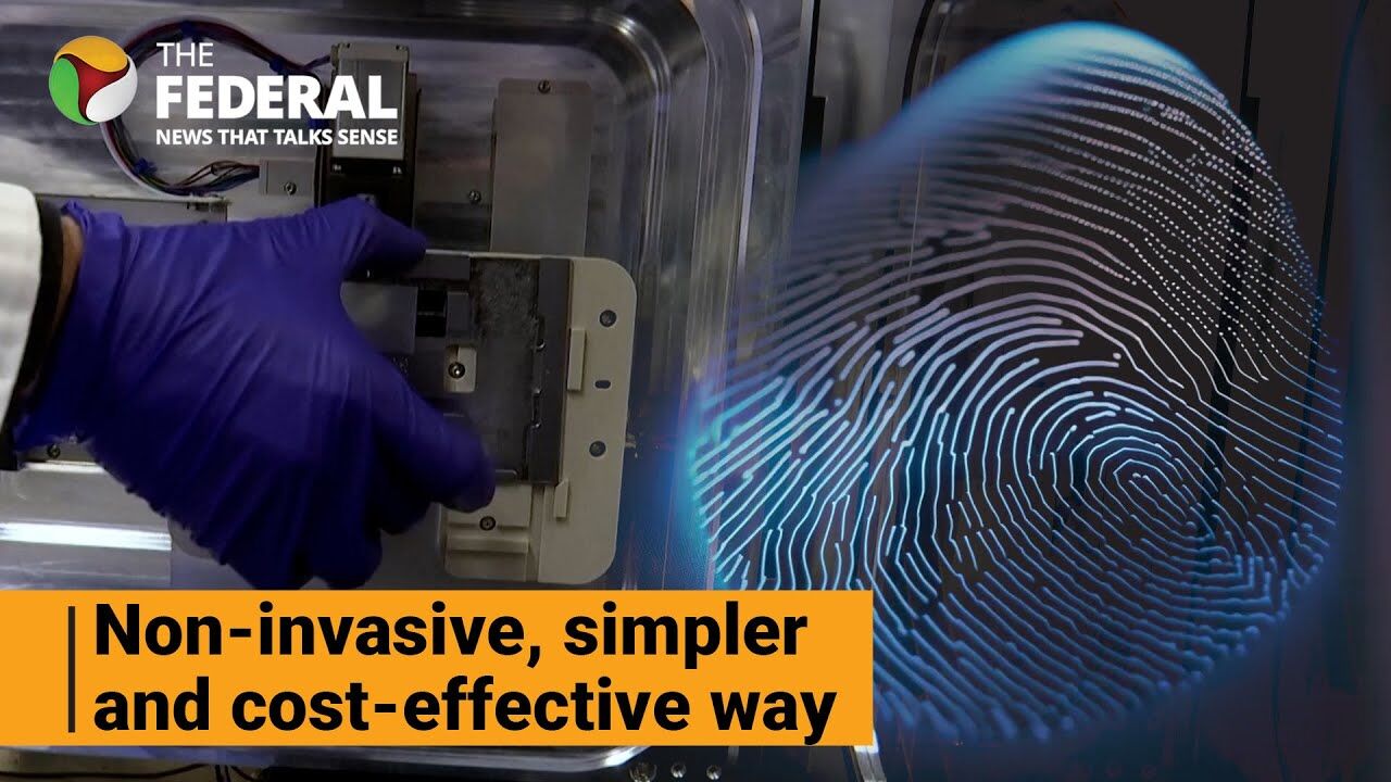 Can fingerprint breast cancer test replace mammograms?